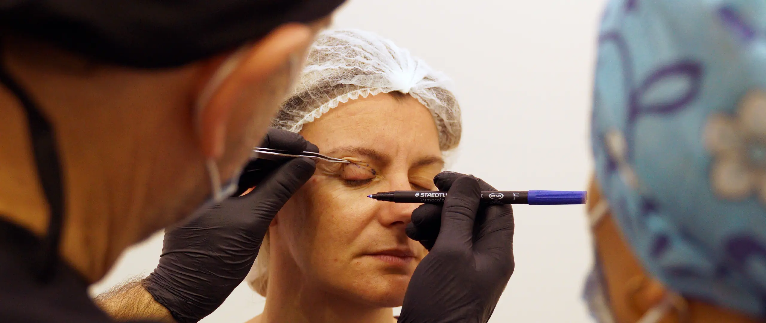 EIMEC cirugia-blefaroplastia-curso practico-barcelona-estetica